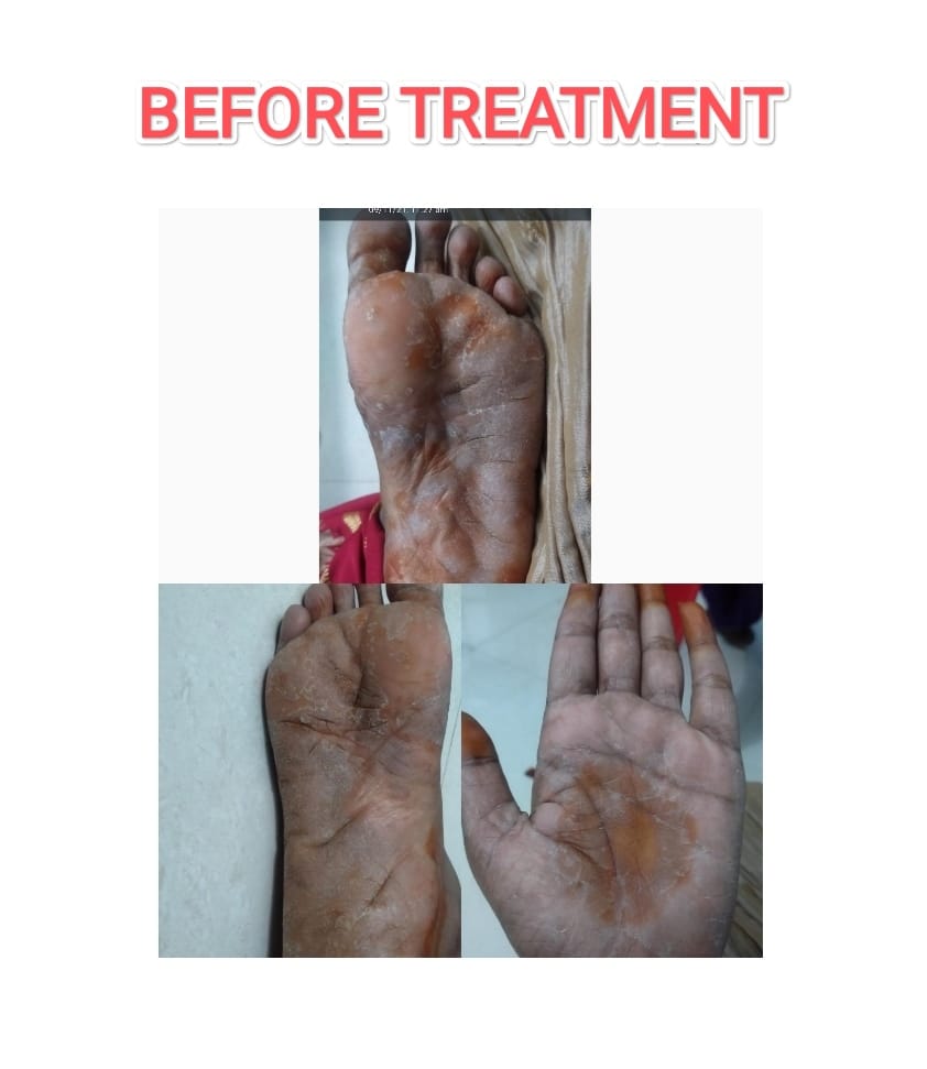 before-treatment