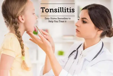 Homeo Treatment for Tonsillitis Problem 